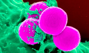 E-cig vapour may increase risk of infection, scientists suggest