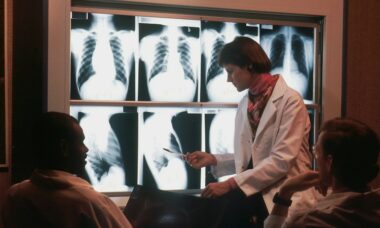 Vaping after quitting smoking may increase lung cancer risk, study finds